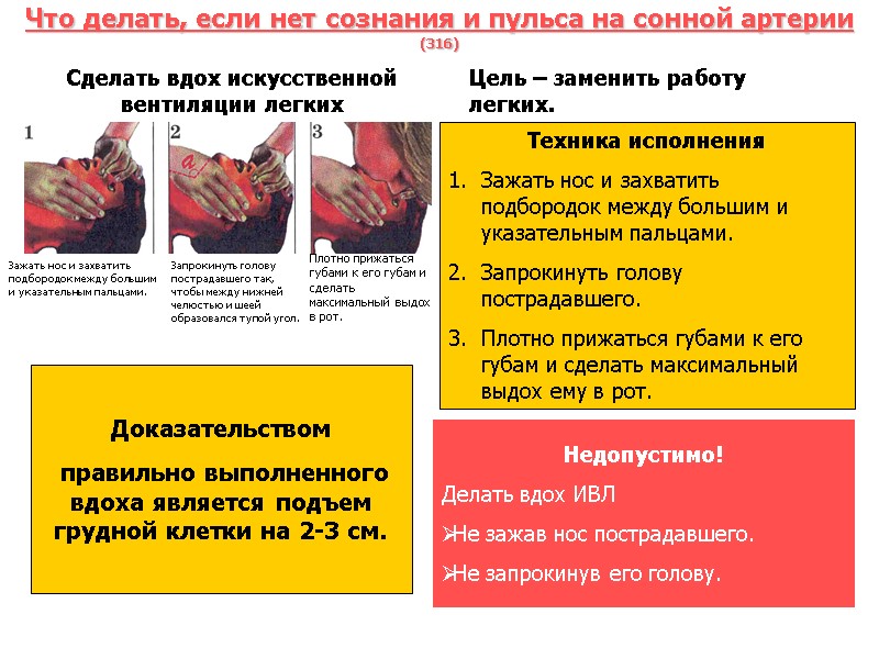Что делать, если нет сознания и пульса на сонной артерии  (316) Сделать вдох